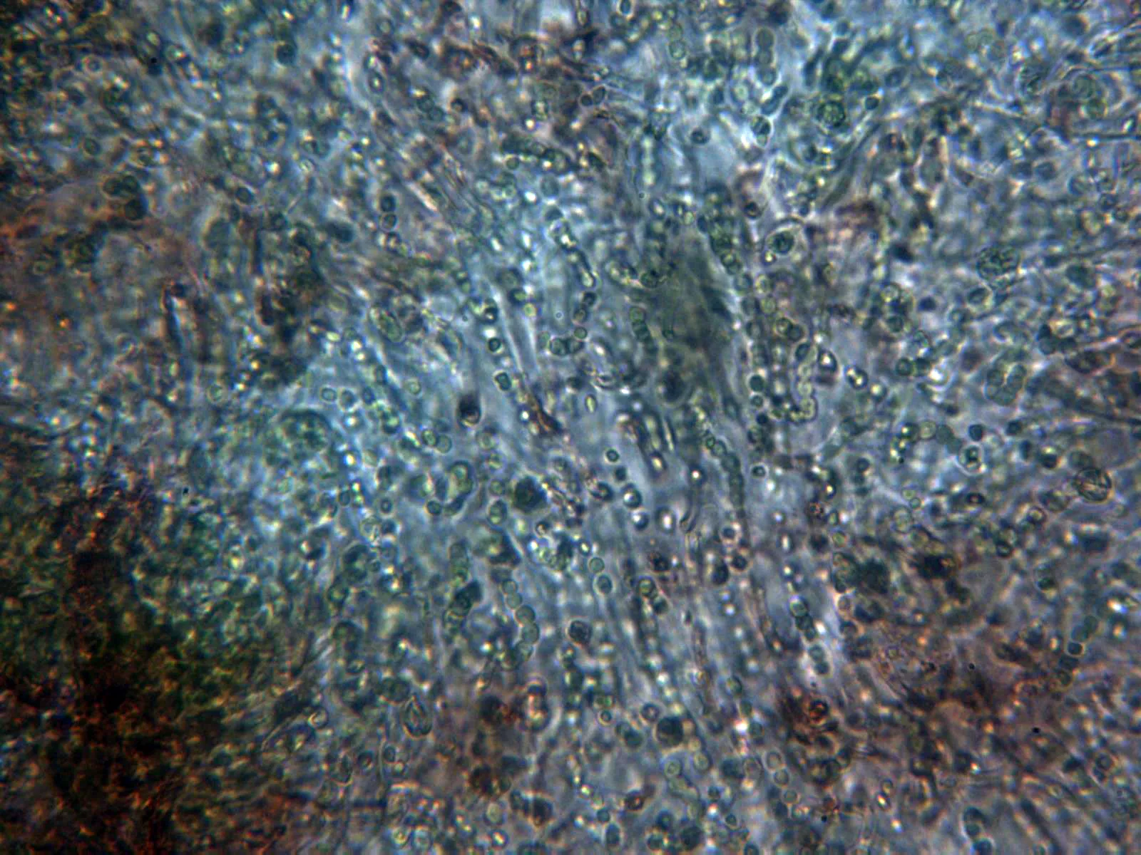 10 - Alga x 400